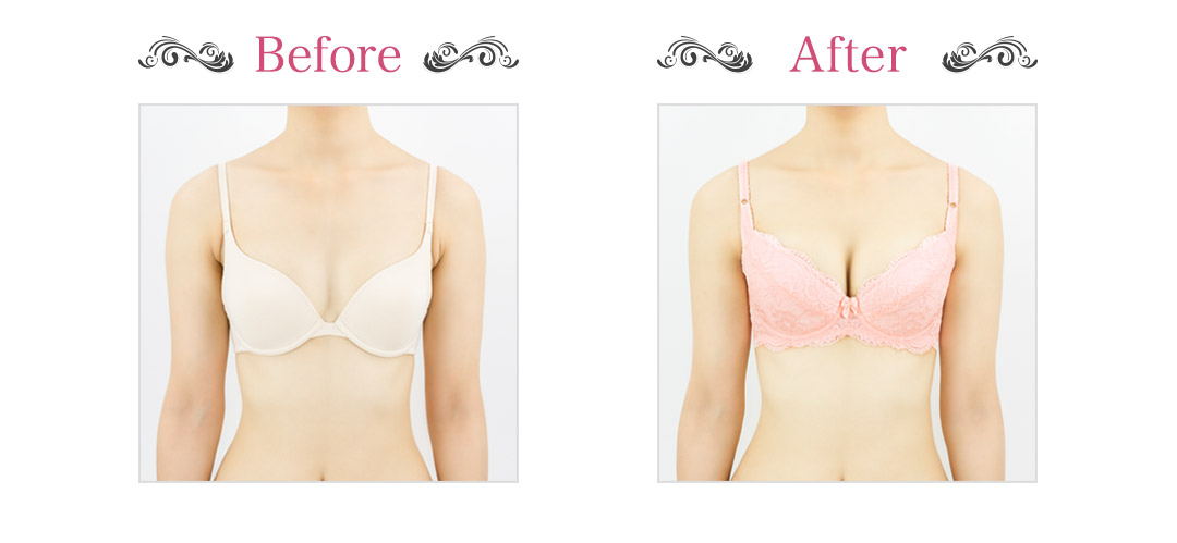 Before & After ヌード前
